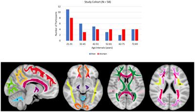 C-NODDI: a constrained NODDI model for axonal density and orientation determinations in cerebral white matter